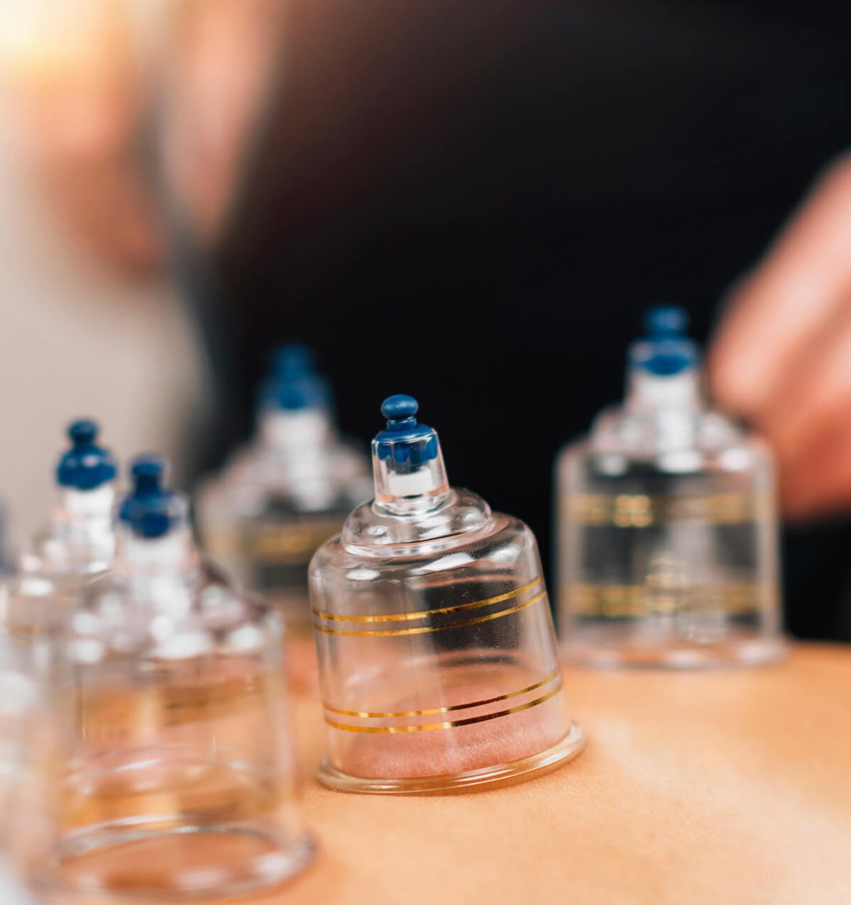 Cupping bij Sport Medics