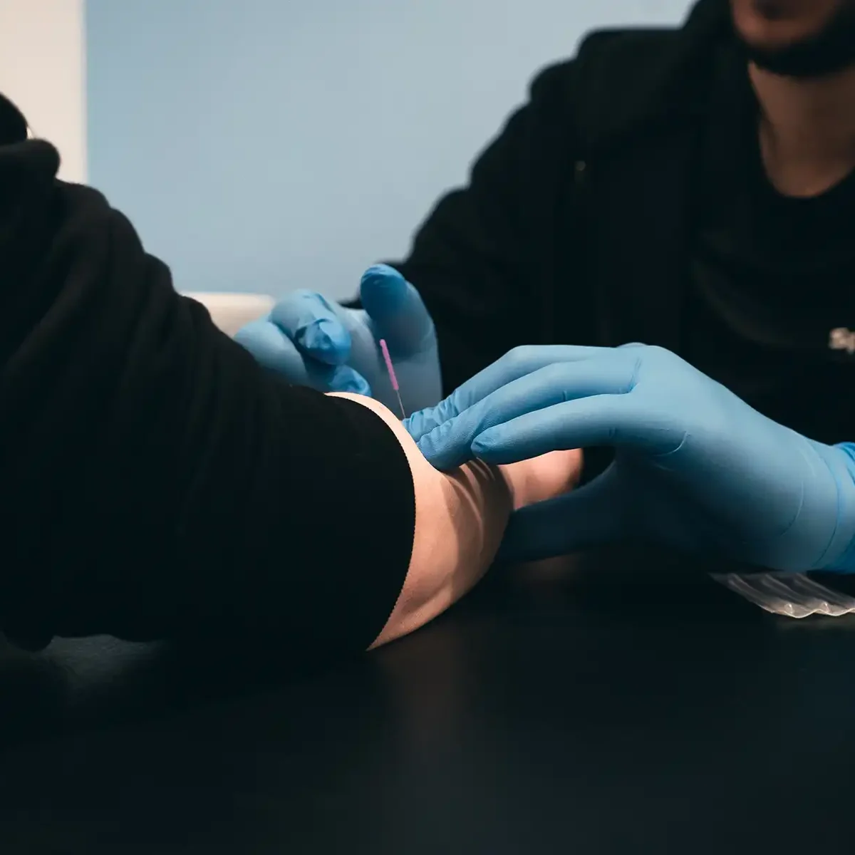 Dry Needling - Sport Medics